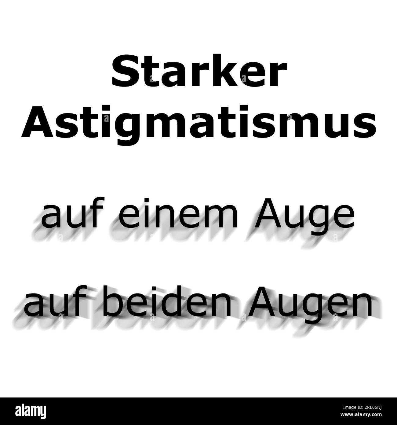 German text meaning: strong Astigmatism in one and in both eyes - with a different angle in the second eye - causing blurred or blurry vision. Stock Photo