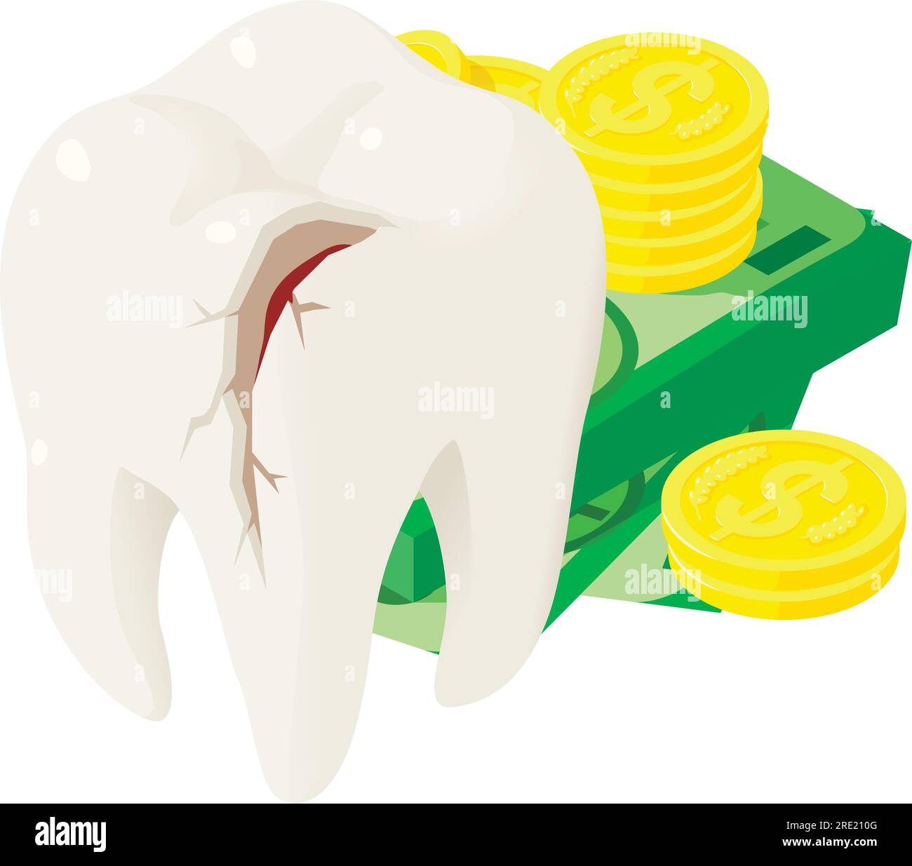 Tooth damage icon isometric vector. Broken human tooth near dollar bill ...