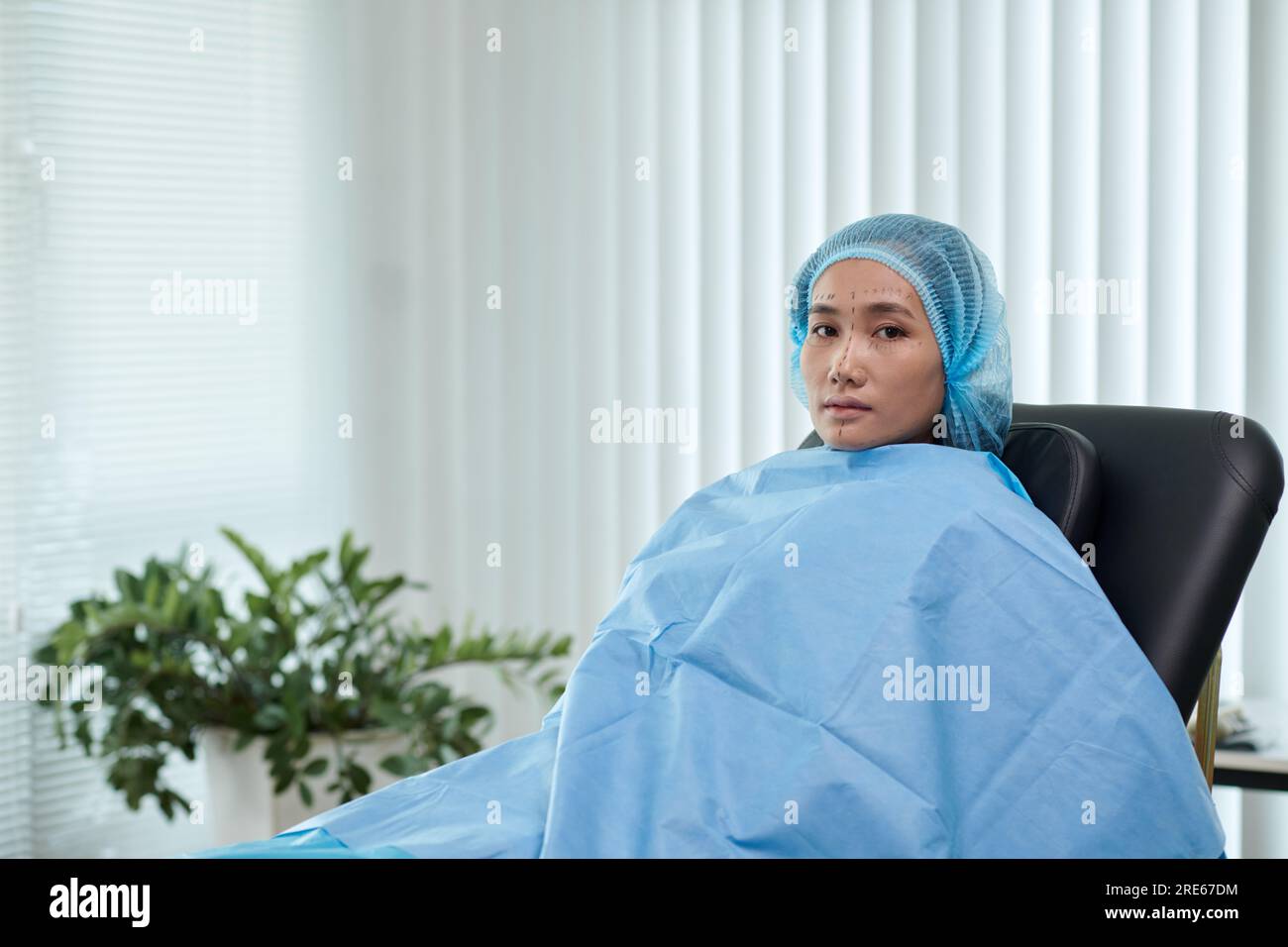 Woman grabbing skin on her flanks with the black color crosses marking,  Lose weight and liposuction cellulite removal concept, Isolated on white  backg Stock Photo - Alamy