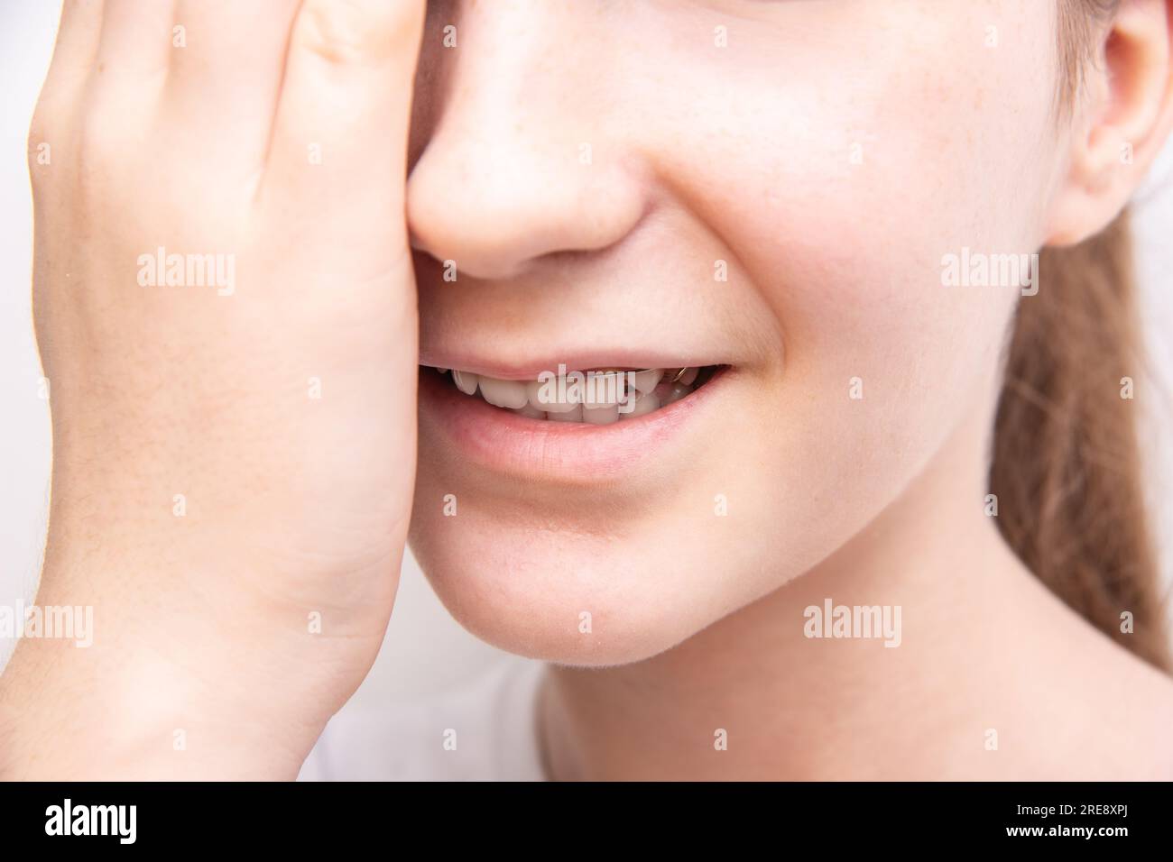 closeup open mouth with iron bracket, teeth hurt and girl holds cheek with hand Stock Photo Alamy