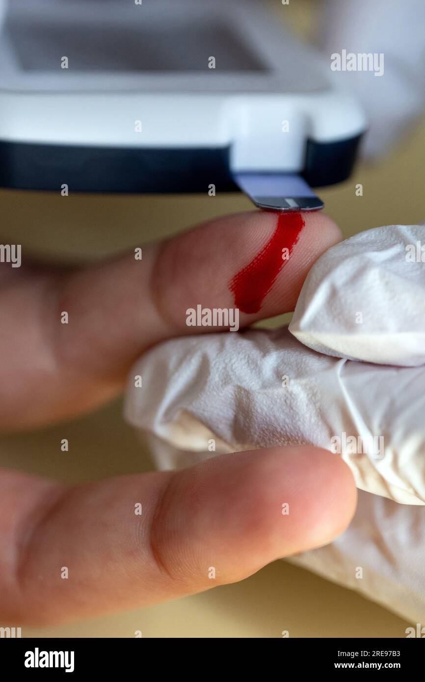 Coburg, Germany. 23rd July, 2023. Using a fine lancet, a nursing student takes a drop of blood from a fingertip to determine blood glucose levels. This week, the first graduates in generalist nursing in Bavaria will receive their graduation certificates. Credit: Pia Bayer/dpa/Alamy Live News Stock Photo