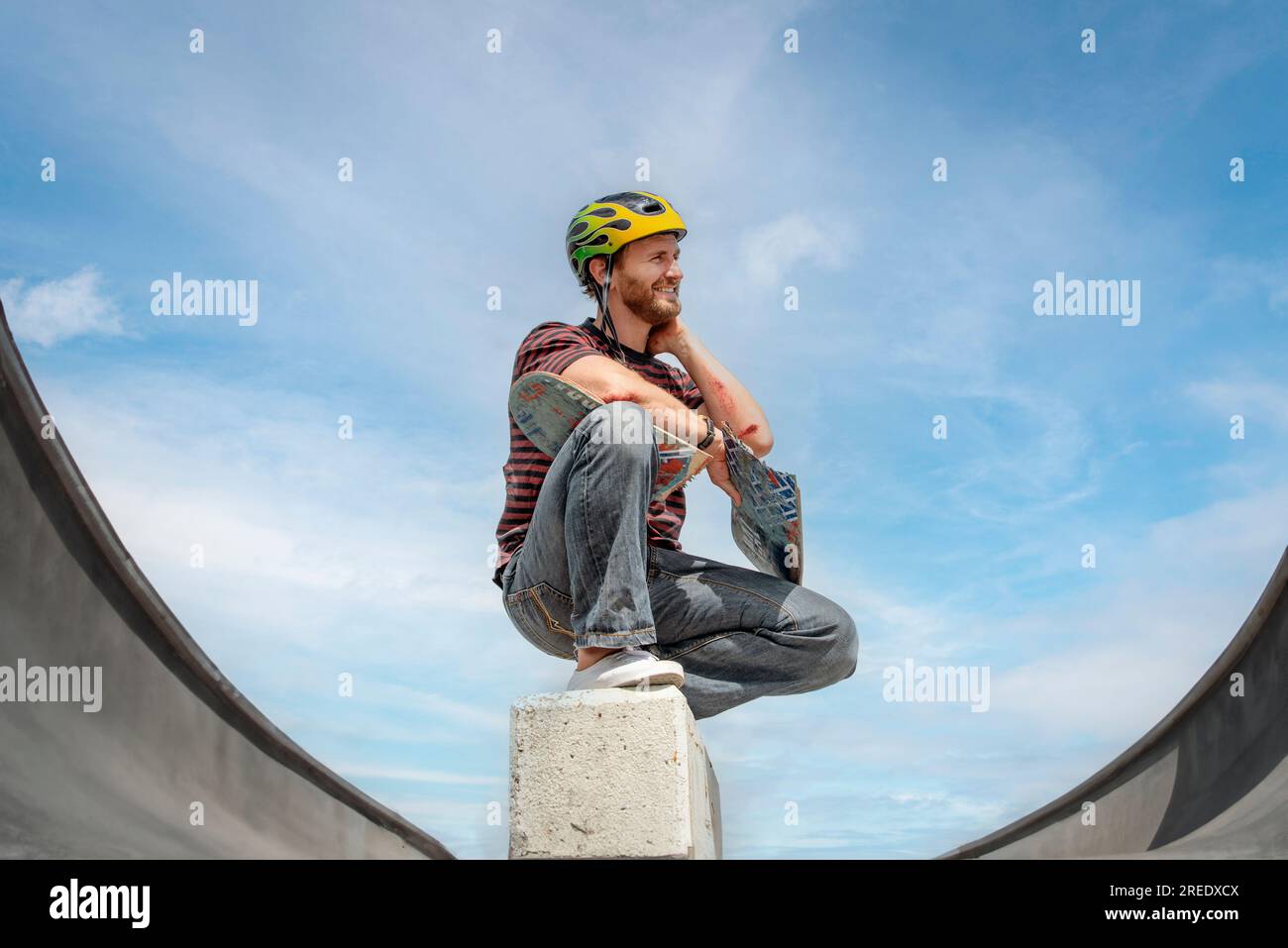 skateboarder holding a broken skateboard with grazes on his arms Stock Photo