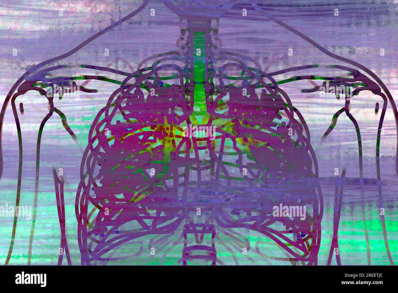 The lungs are the organ in our body that provides the vital oxygen from