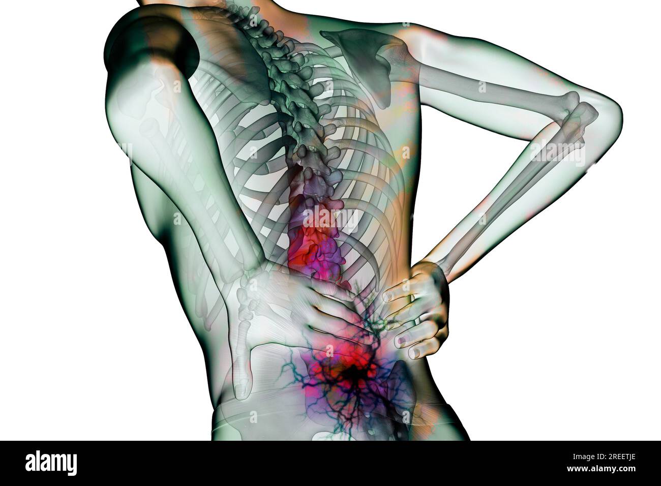 Back pain is a common condition and is particularly caused by sedentary ...