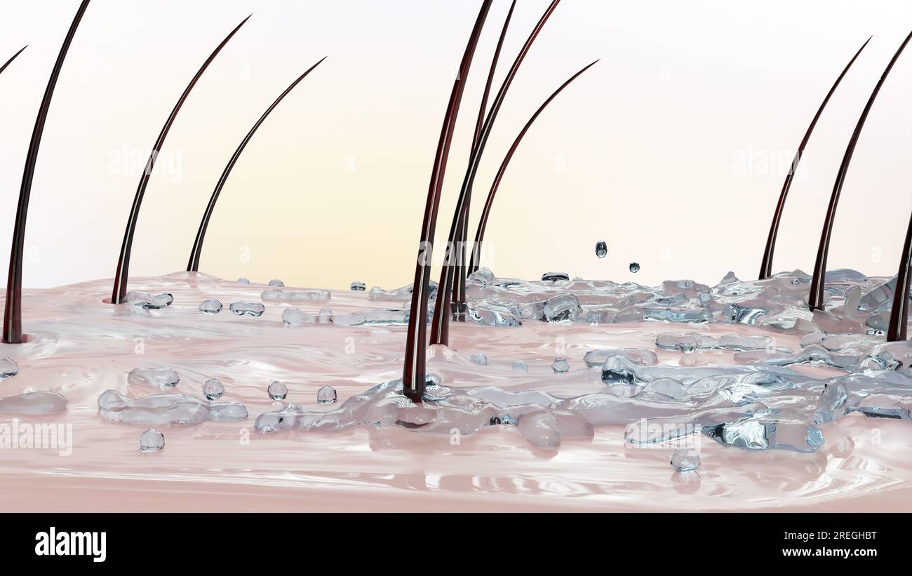 Treatment against Dandruff, Serum nourish, Dermatitis occur, hair care