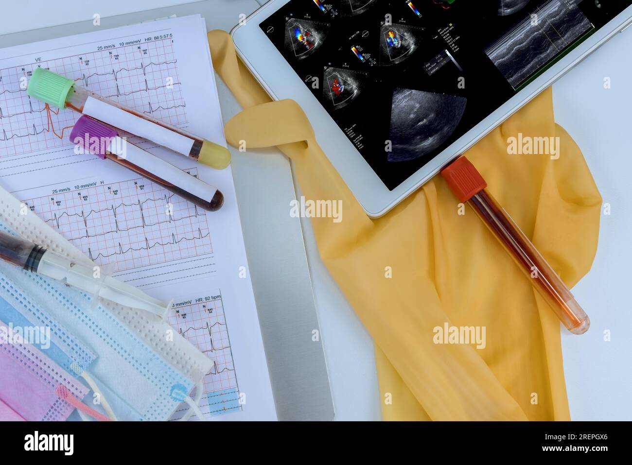 Through cardiac activity monitoring with ultrasound echocardiography