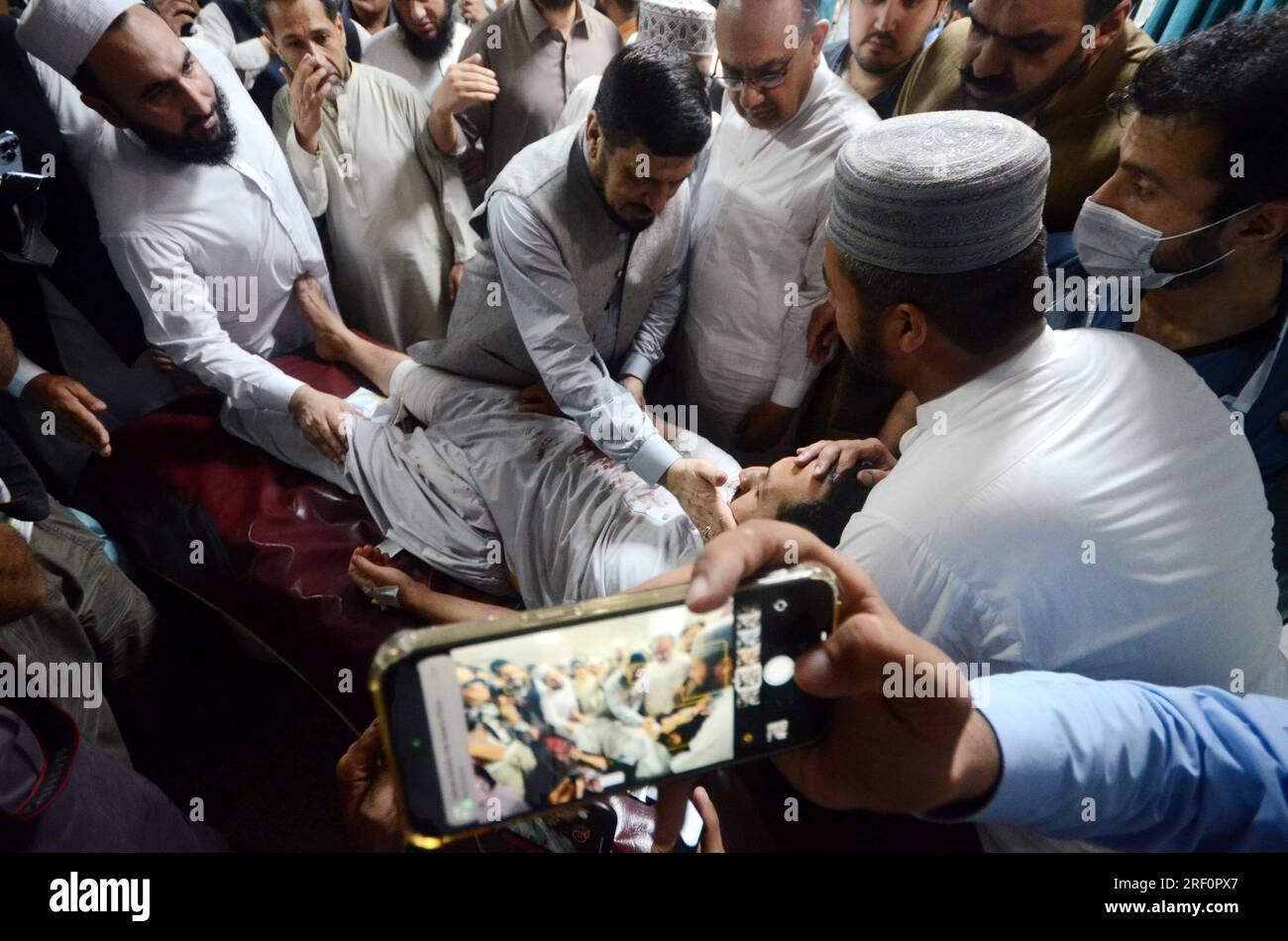 Peshawar, Pakistan. 30th July, 2023. An injured man is shifted to a hospital following a blast targeting a gathering of Islamic political party Jamiat Ulma-e-Islam (JUI-F). At least 40 people were killed and several injured in an explosion at the JUI-F workers convention in Khar, police said. (Credit Image: © Hussain Ali/ZUMA Press Wire) EDITORIAL USAGE ONLY! Not for Commercial USAGE! Stock Photo