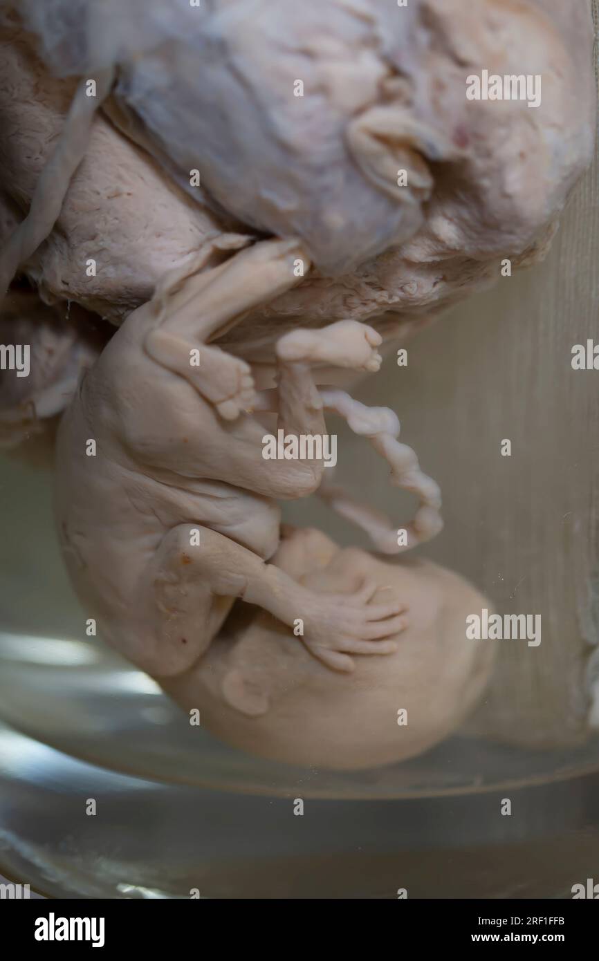 Four months old baby in best sale the womb