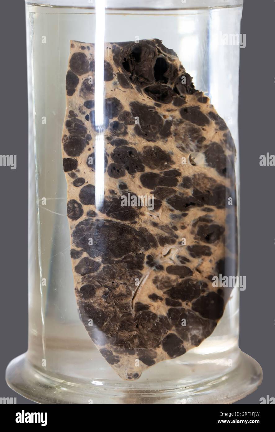 April 1, 2023 Exhibition of the anatomical exhibit of human liver