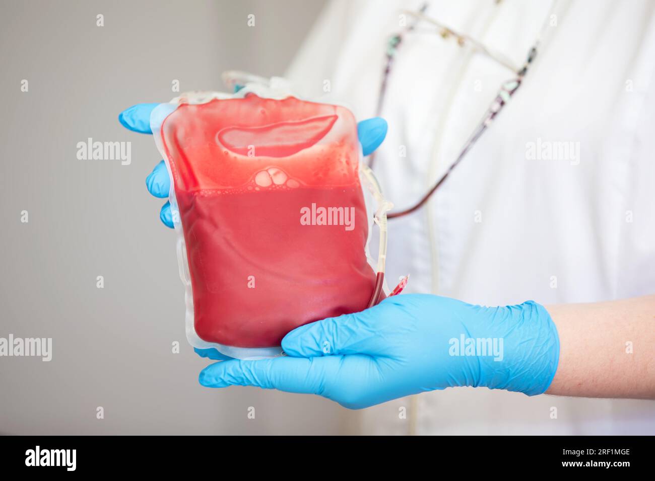 Blood plasma in the center of transfusiology and donation. close up the blood bag in the