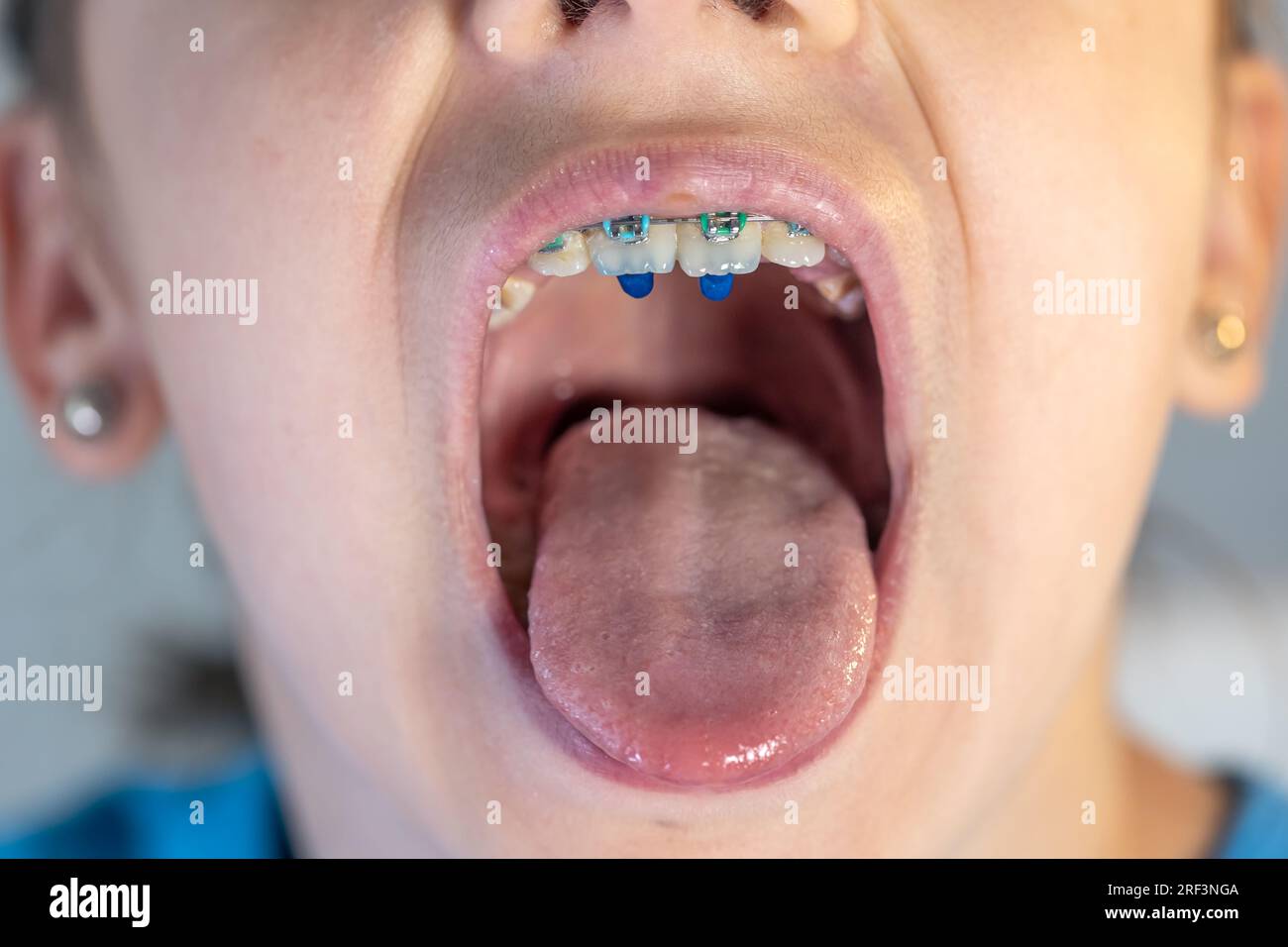 A Child Girl Open Her Mouth And Show Her Tounge Stock Photo Alamy A Child Girl Open Her Mouth And Show Her Tounge Stock Photo Alamy