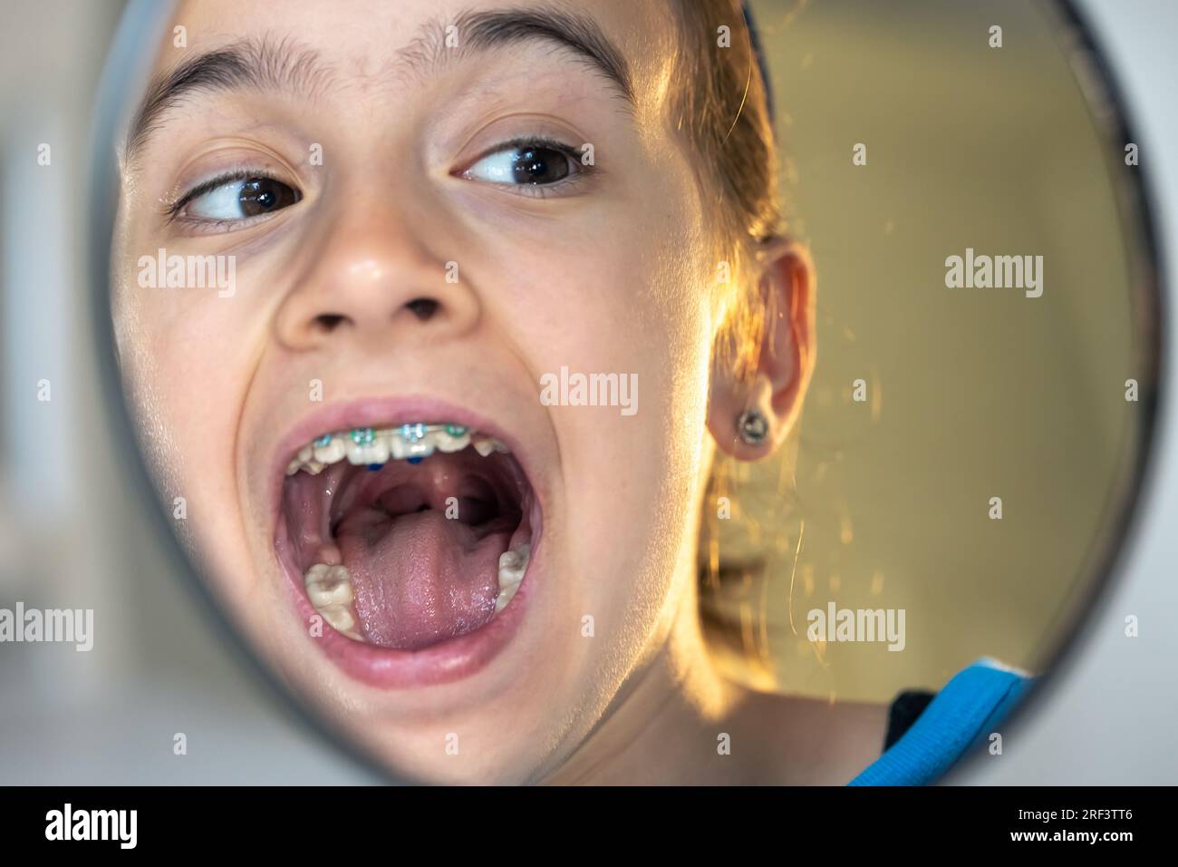 Caucasian preteen girl with braces on her teeth looking at the mirror