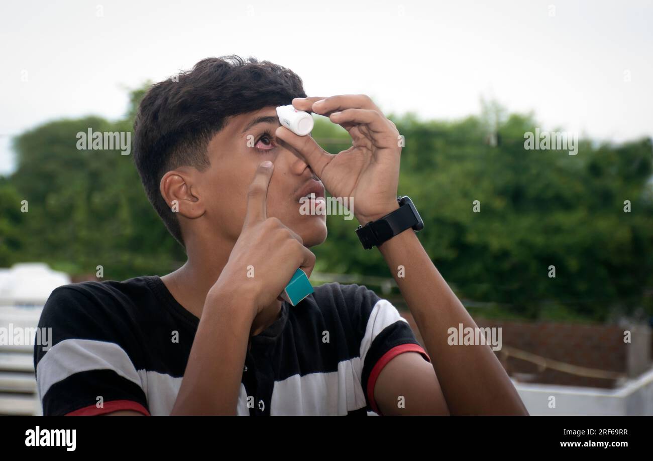 eye flu, acute conjunctivitis patient, asian patient has red eyes and