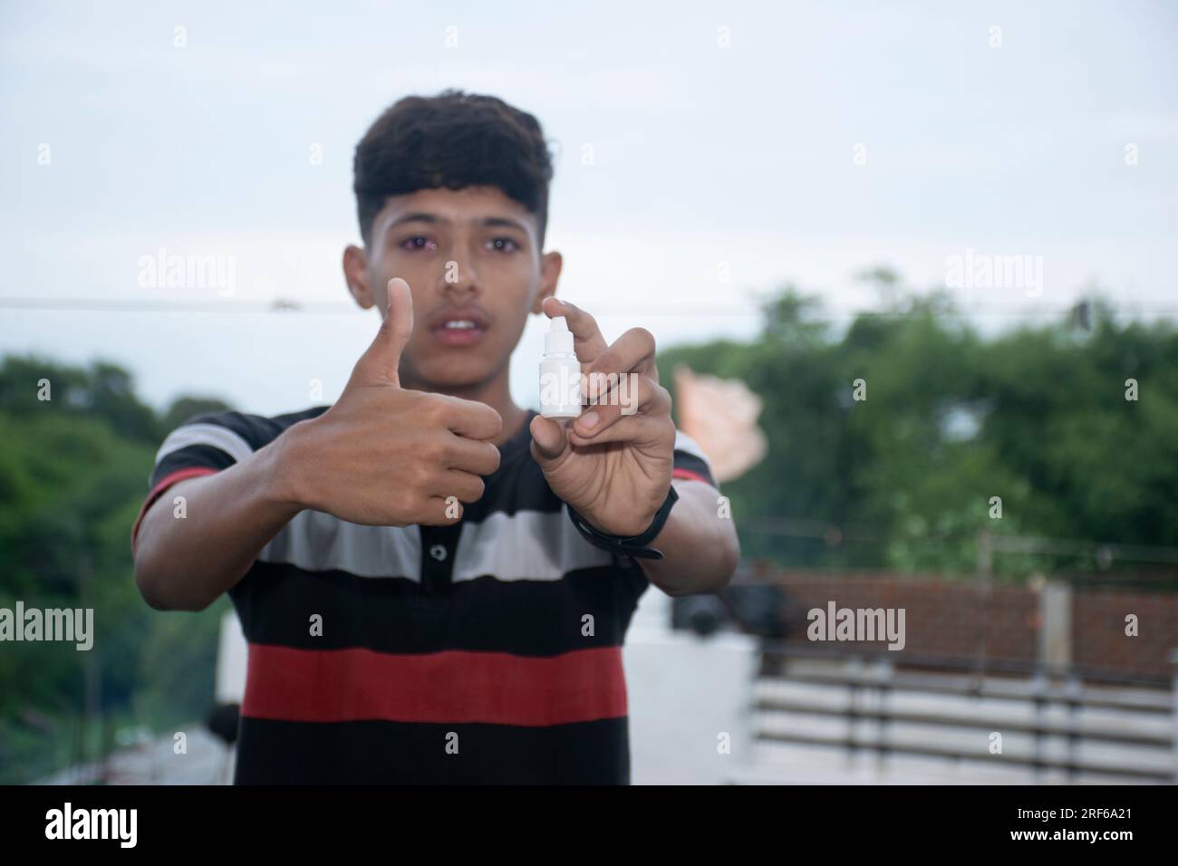 eye flu, acute conjunctivitis patient, asian patient has red eyes and