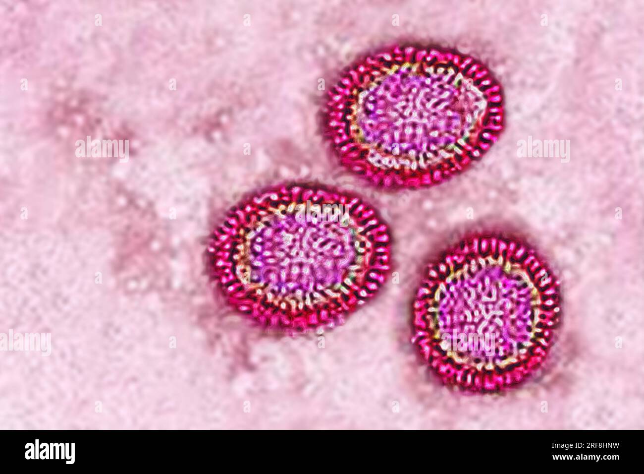 Influenza virus of the Orthomyxoviridae family (respiratory viral infection). Transmission electron microscopy, viral diameter 80 to 120 nanometers. Stock Photo