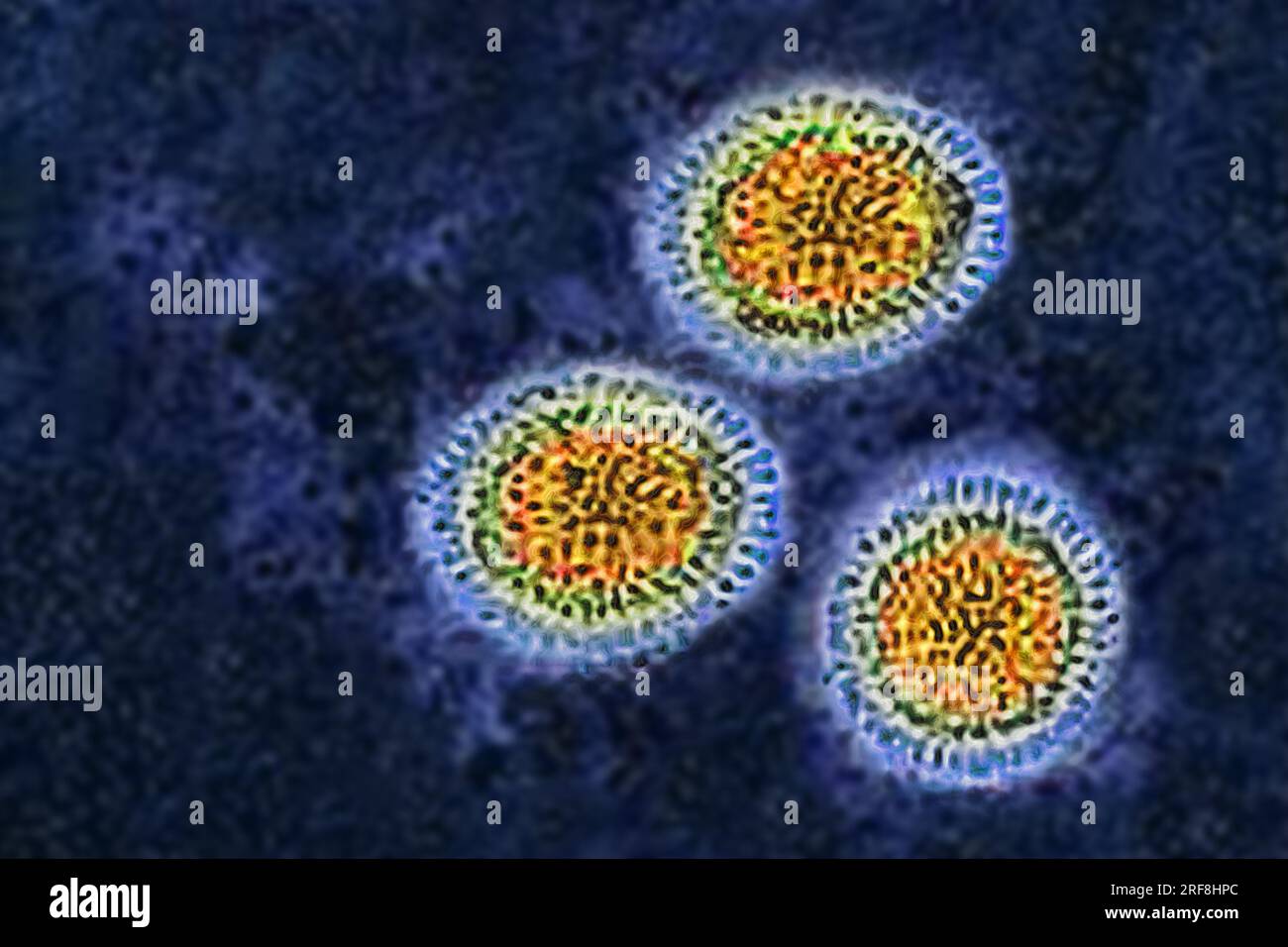 Influenza virus of the Orthomyxoviridae family (respiratory viral infection). Transmission electron microscopy, viral diameter 80 to 120 nanometers. Stock Photo