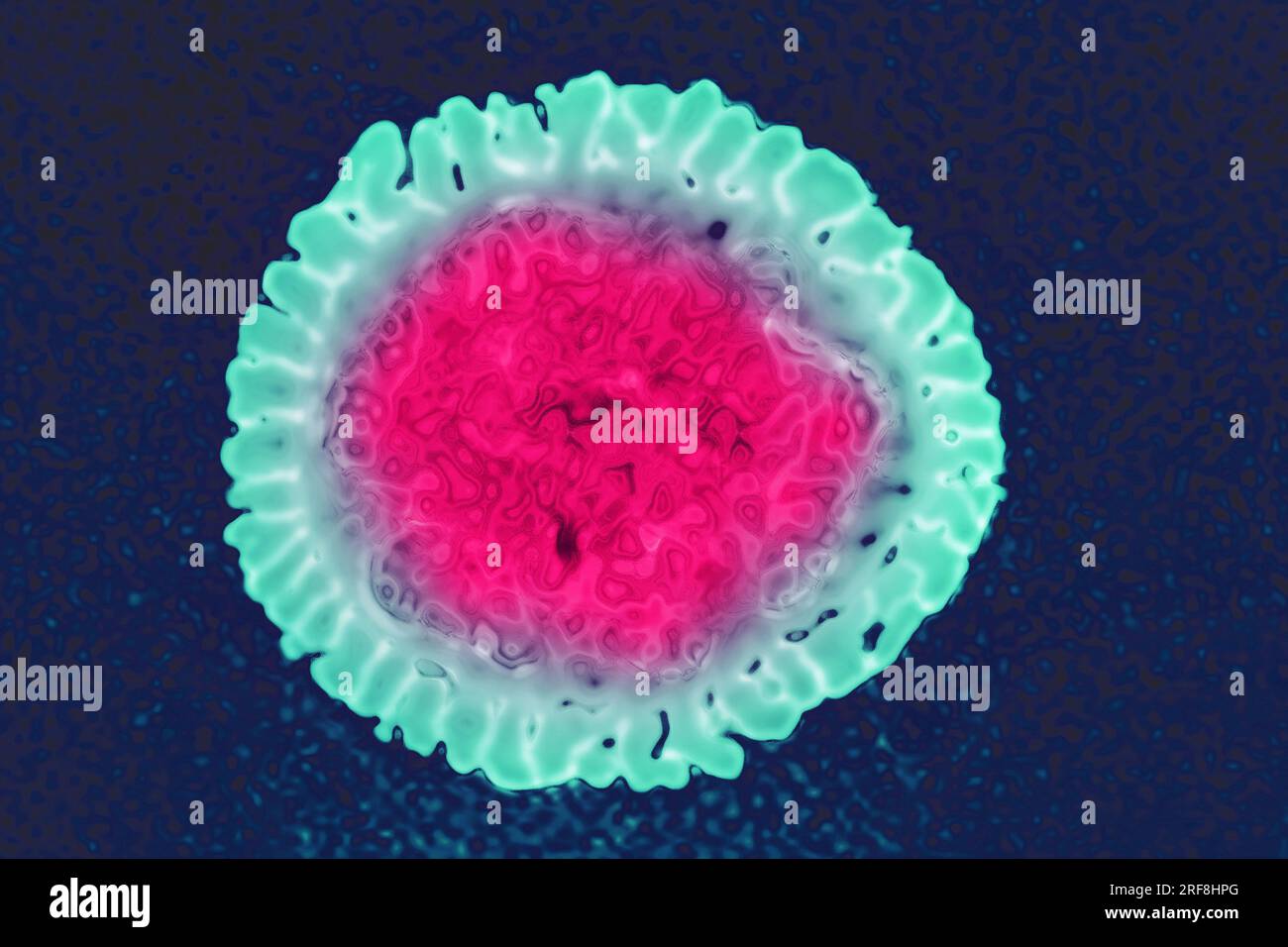 Influenza virus of the Orthomyxoviridae family (respiratory viral infection). Transmission electron microscopy, viral diameter 80 to 120 nanometers. Stock Photo