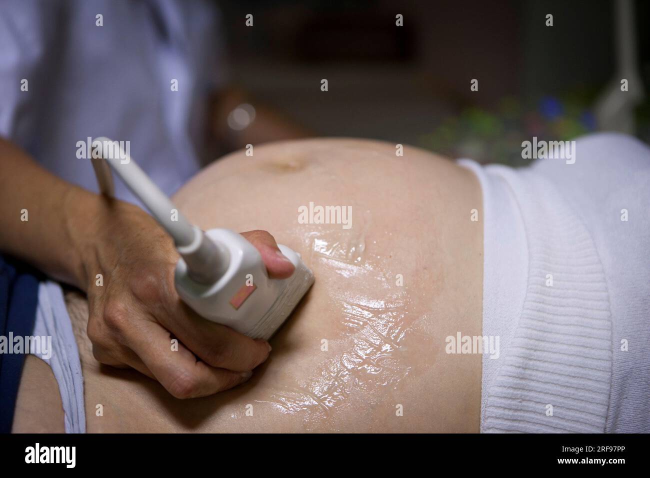 Ultrasound of a pregnant woman at 6 months of pregnancy in the maternity ward of a hospital. Stock Photo