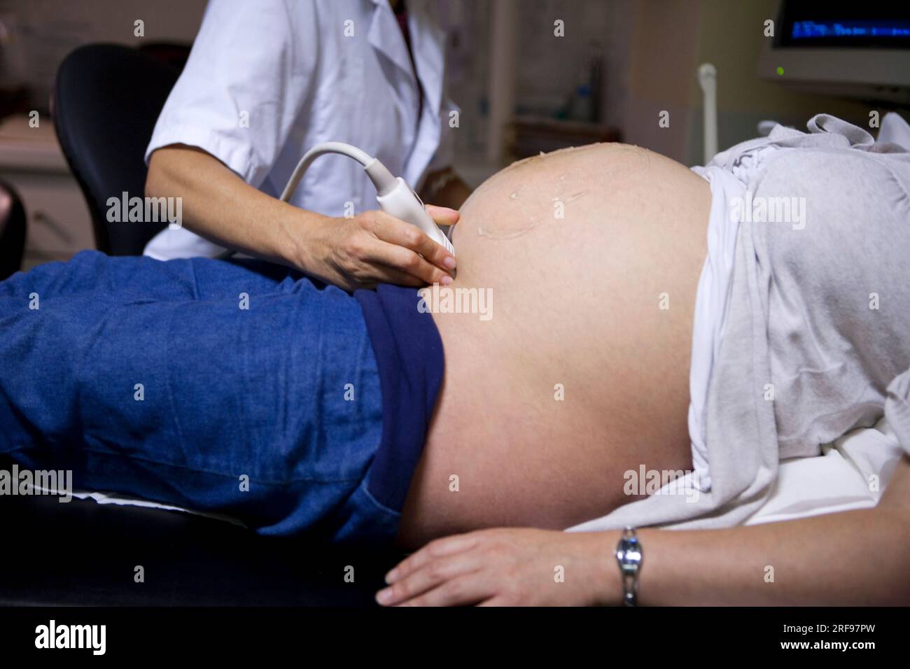 Ultrasound scan of a pregnant woman at 8 months of pregnancy in the maternity ward of a hospital. Stock Photo