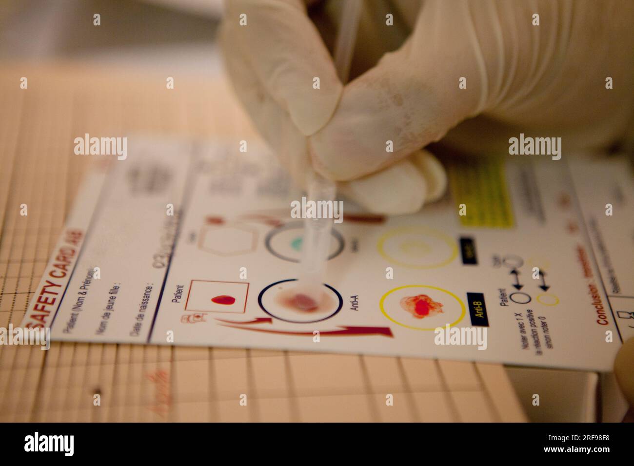 Biological compatibility test before a postoperative blood transfusion