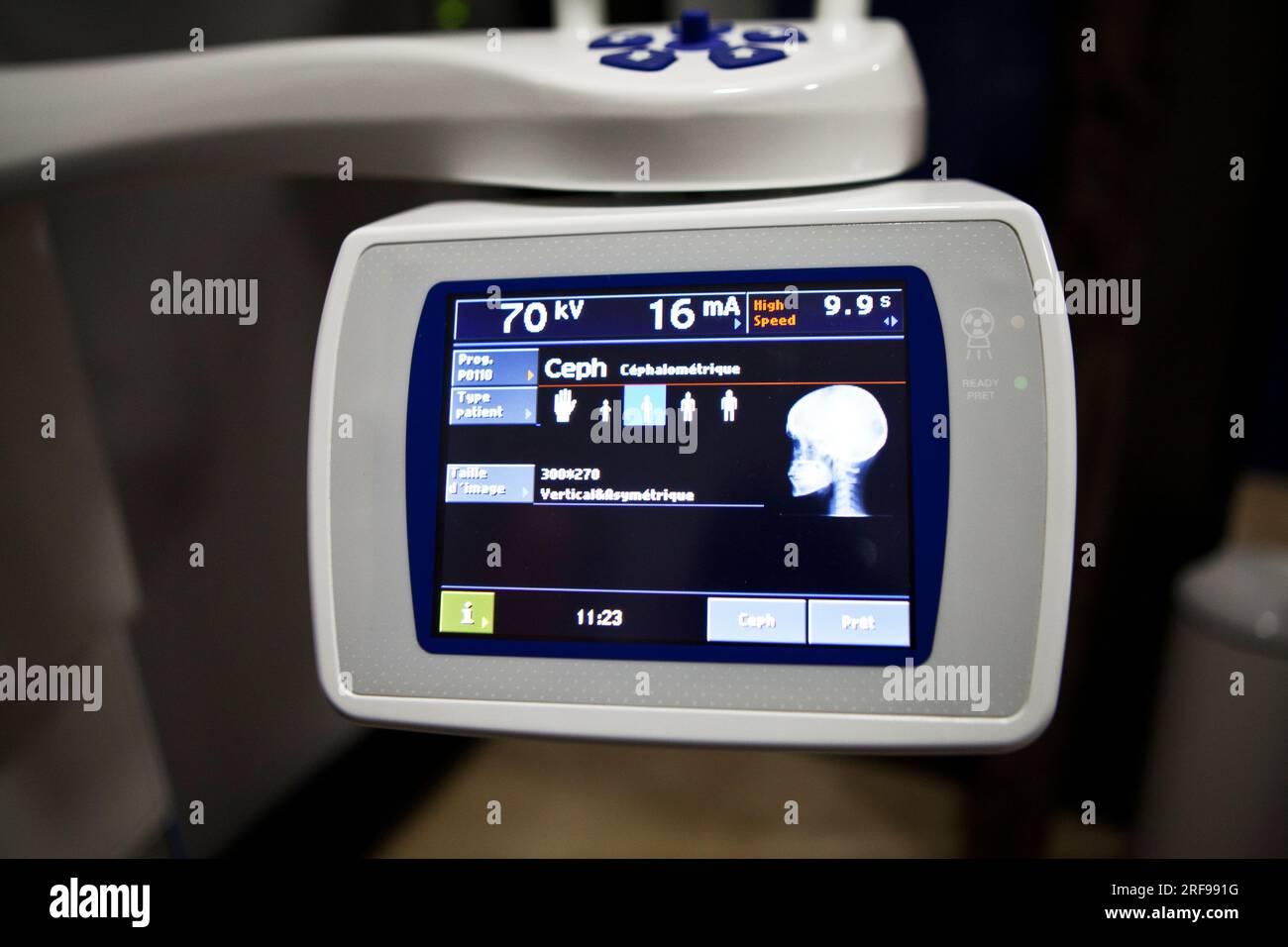 Digital medical imaging center, dental teleradiography in profile Stock