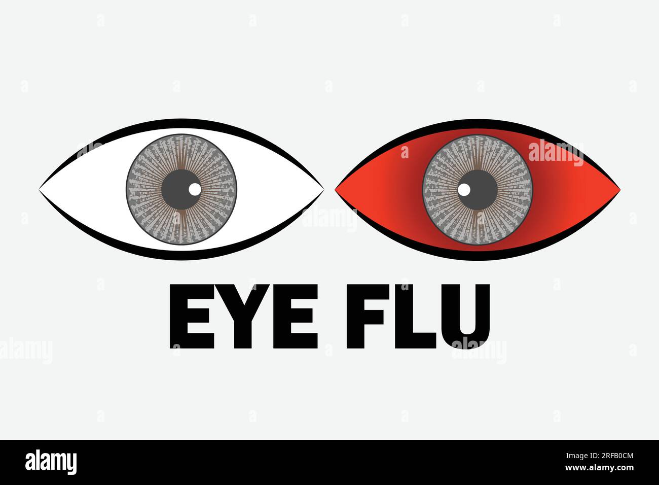 eye flu infection concept vector illustration. Suitable for greeting