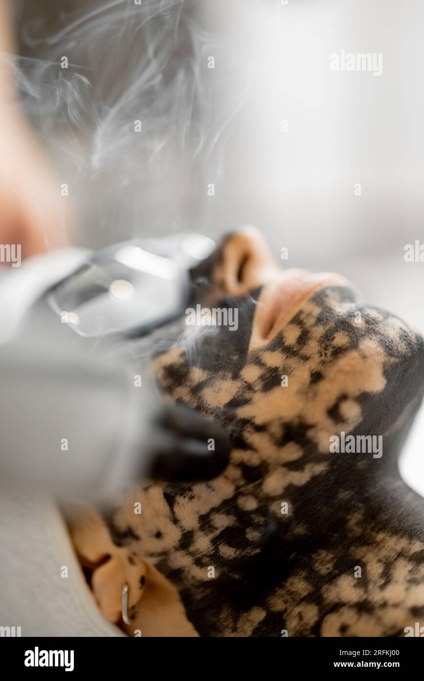 Close up carbon face peeling hi-res stock photography and images - Alamy