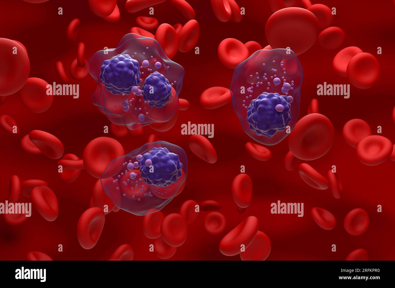 Multiple myeloma cells cluster in the blood flow - isometric view 3d illustration Stock Photo