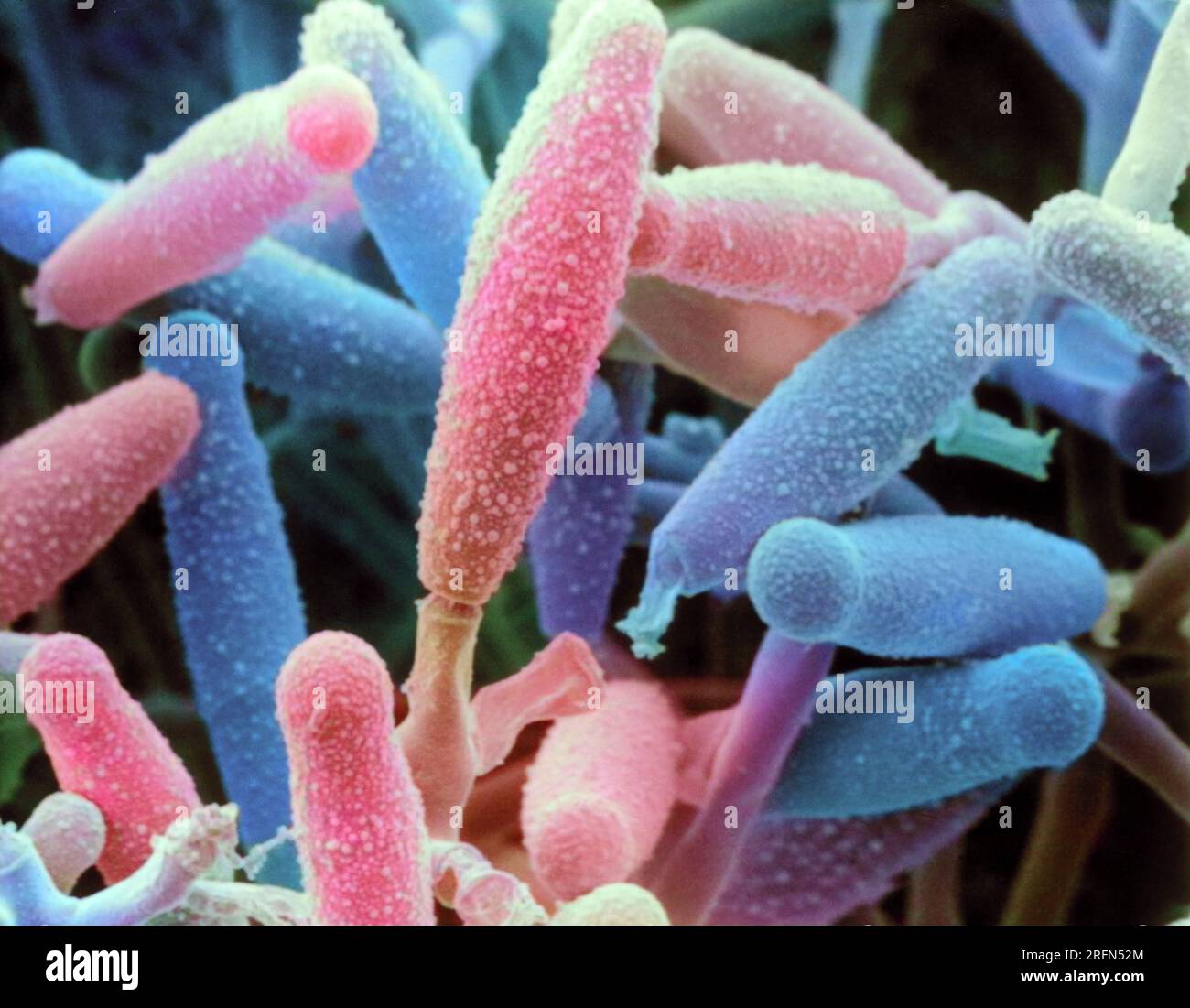 Scanning Electron Micrograph (SEM) of Microsporum gyseum. Microsporum gyseum is a fungus that causes infection of the hands, face, and scalp in humans. Rough walled cigar-shaped macroconidia. Magnification: 1576 Stock Photo