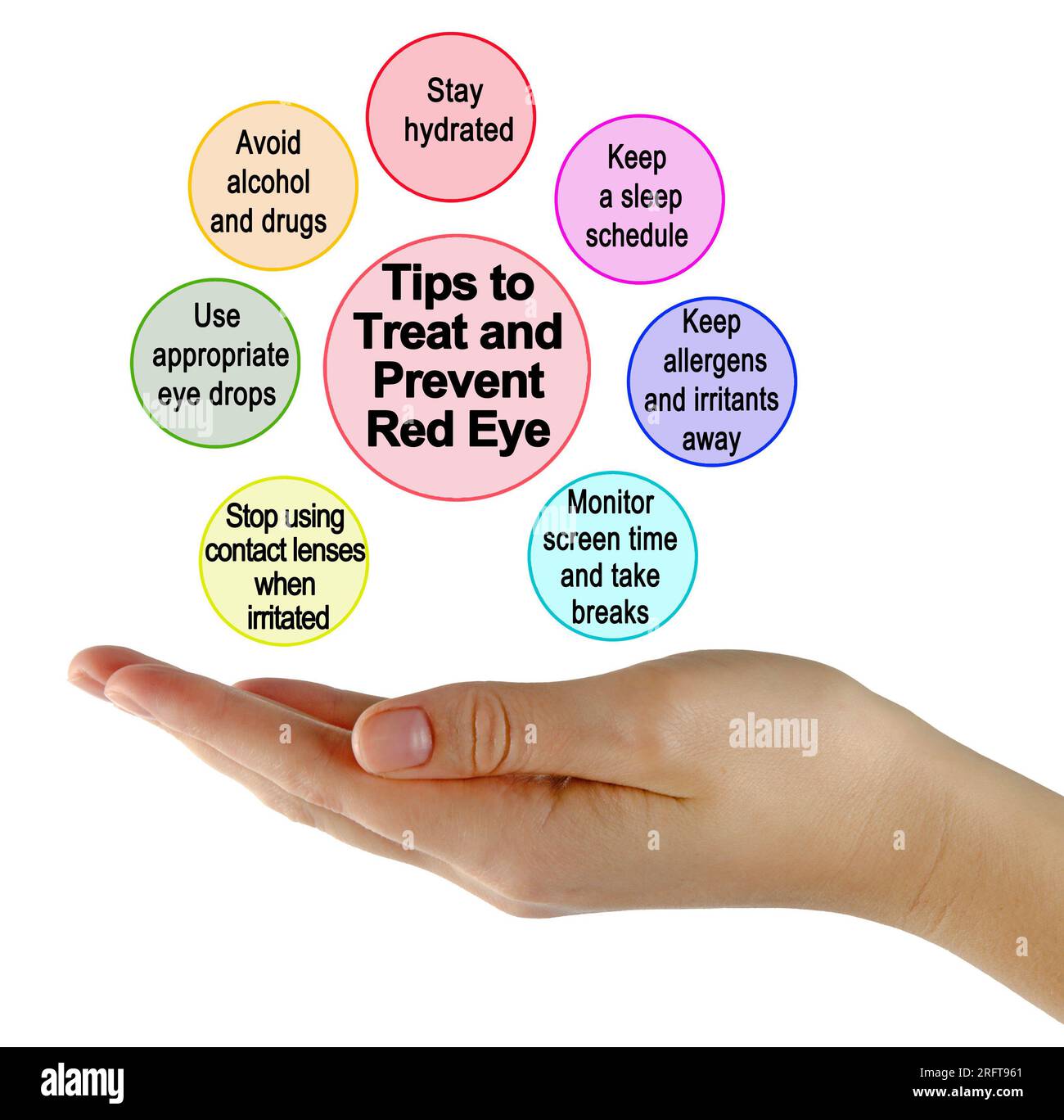 Tips to Treat and Prevent Red Eye Stock Photo Alamy