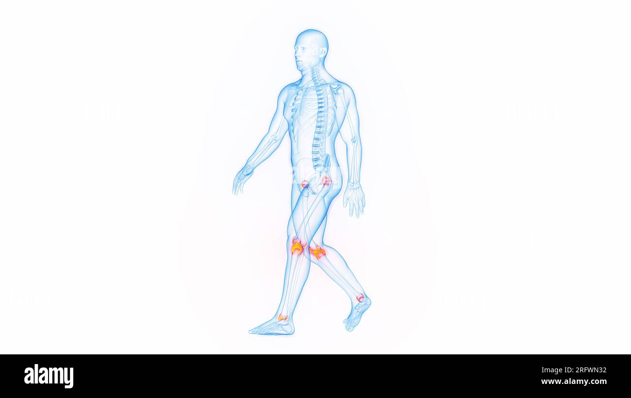 Joint pain while walking, illustration Stock Photo Alamy