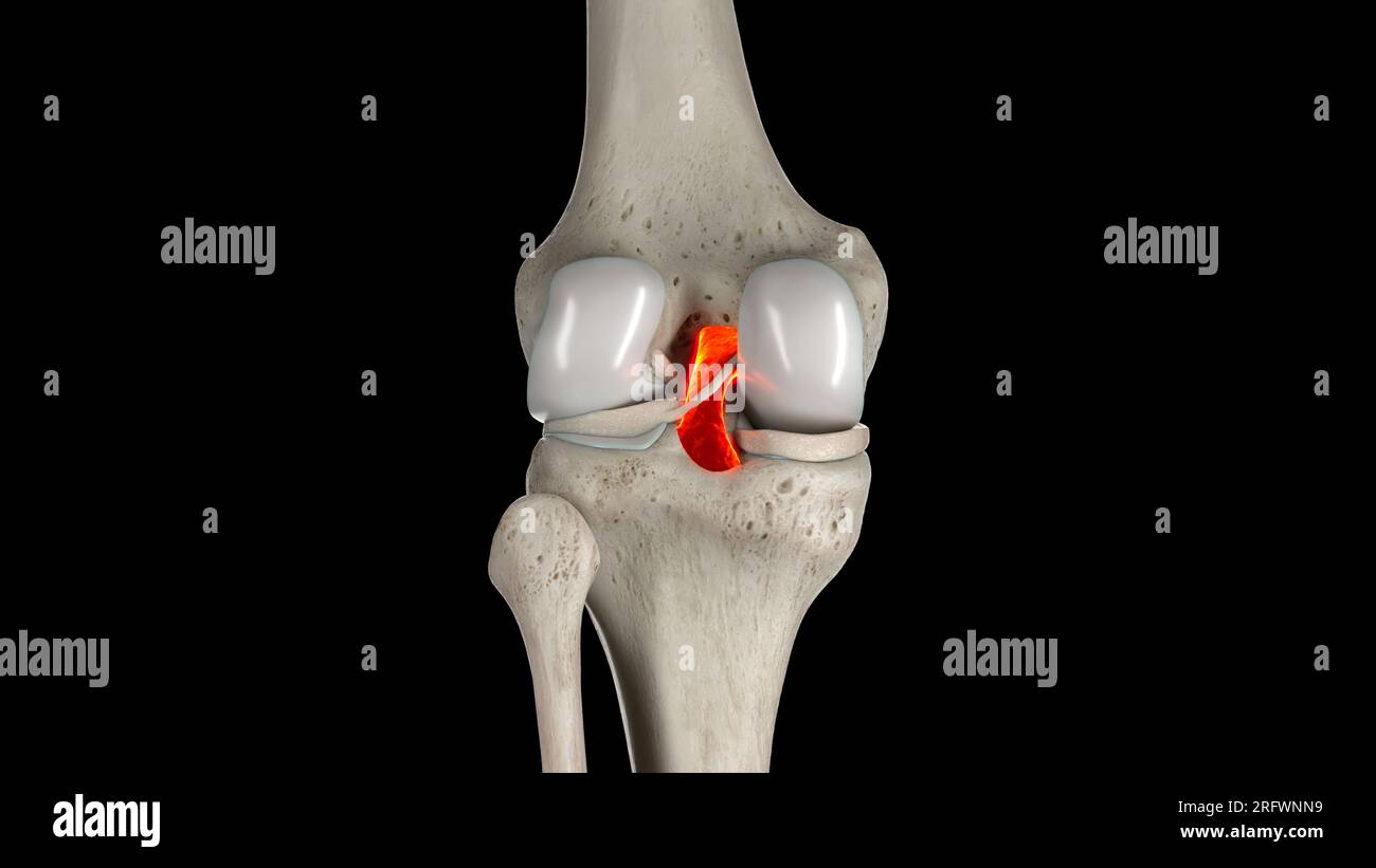 Posterior cruciate ligament, illustration Stock Photo - Alamy