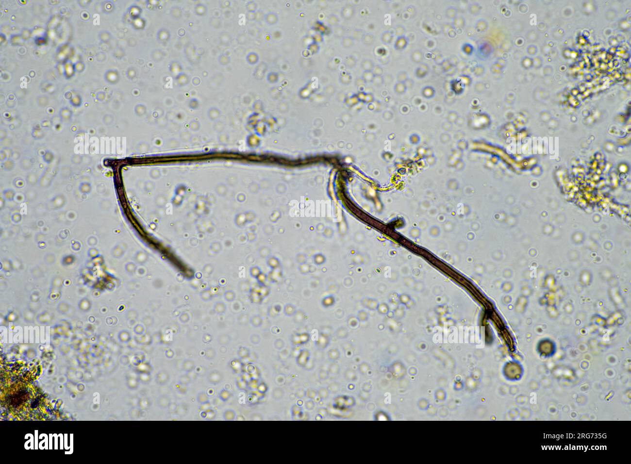 Fungi Under Microscope 10x