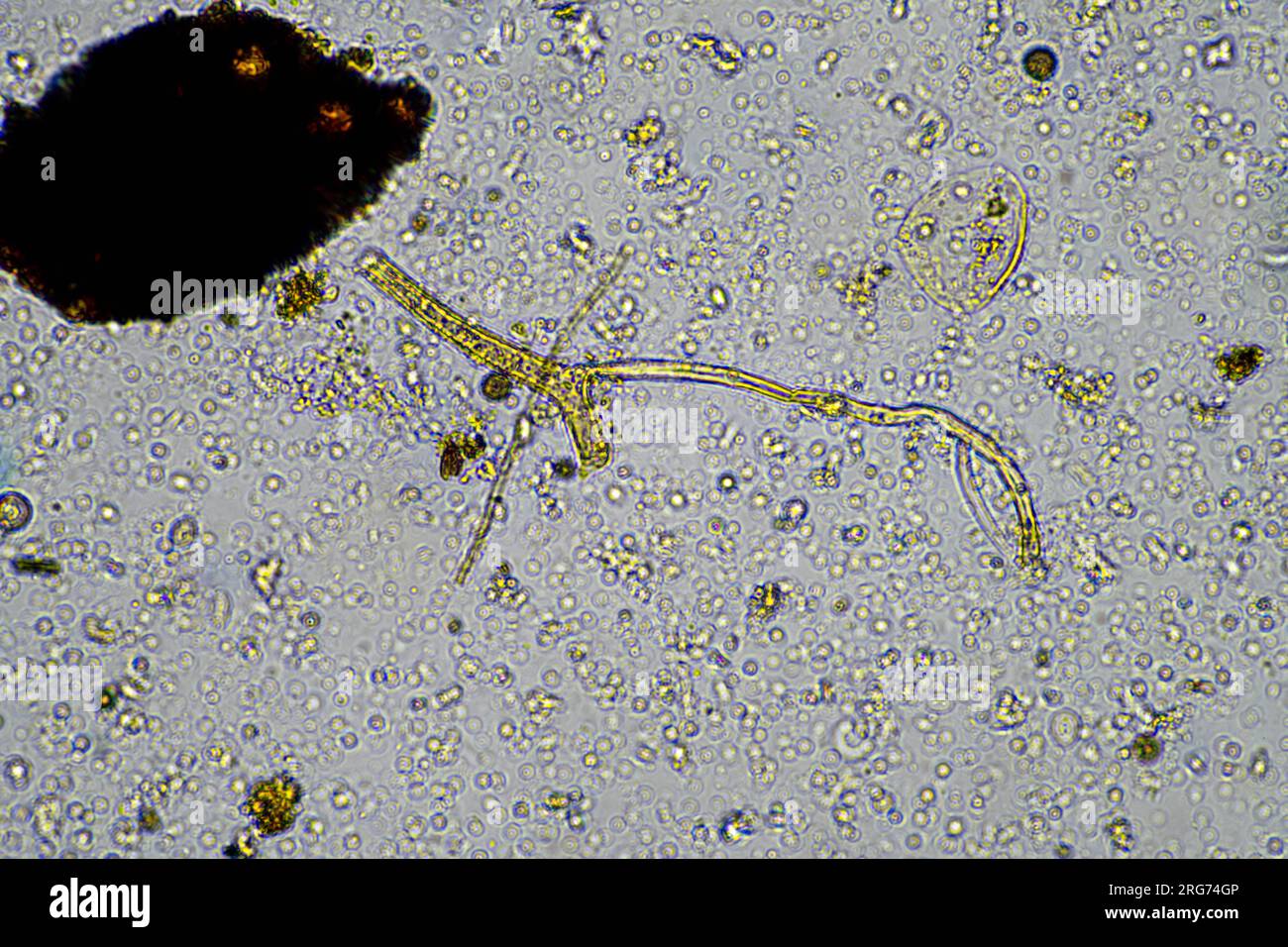 Fungal research material hi-res stock photography and images - Alamy