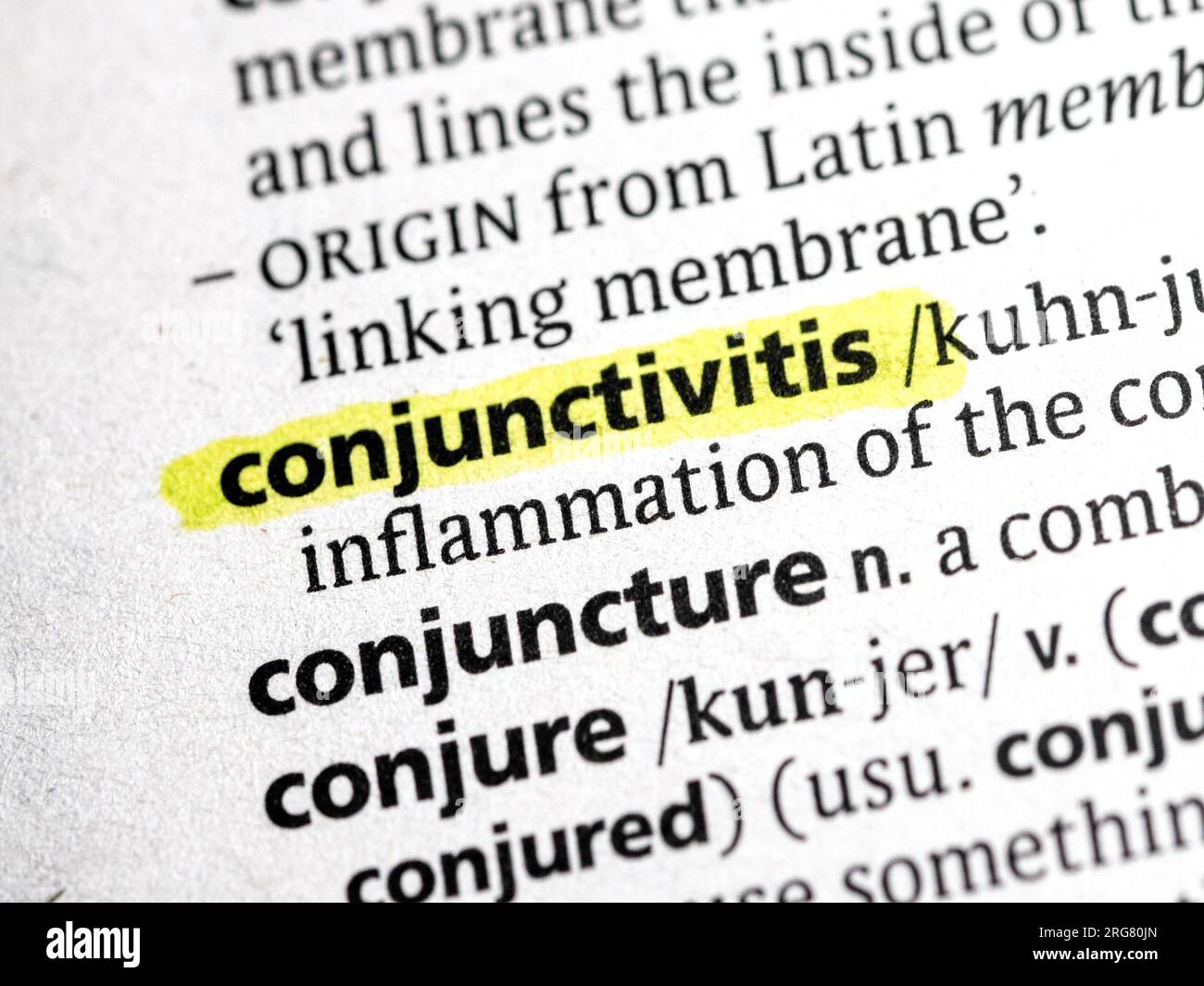 Conjunctivitis eye hi-res stock photography and images - Alamy