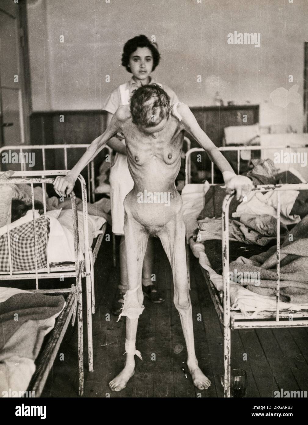 Vintage World War 11 WW2 photograph - Jewish concentration camp survivor Margit Shcwartz, aged 31,  of Budapest, in hospital. According to the caption she chose to pull herself into this position unaided, so she could be photographed, having previously been vitually unable to move. Stock Photo