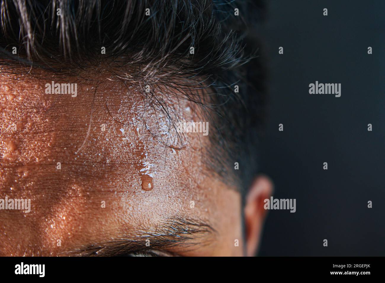 closeup of sweat on forehead against dark background , Stock Photo