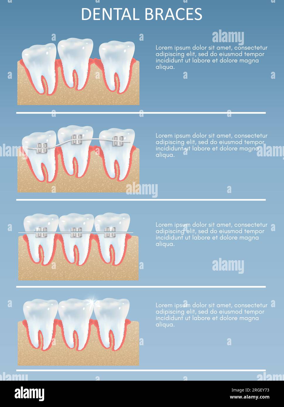 10 Essential Strategies To permanent tooth prosthesis