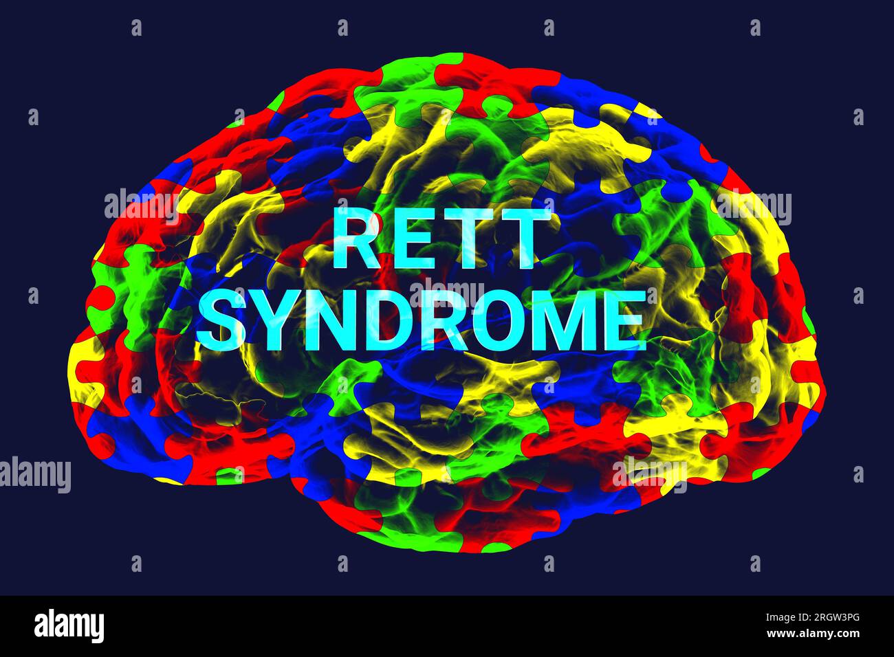 Rett syndrome, conceptual illustration Stock Photo