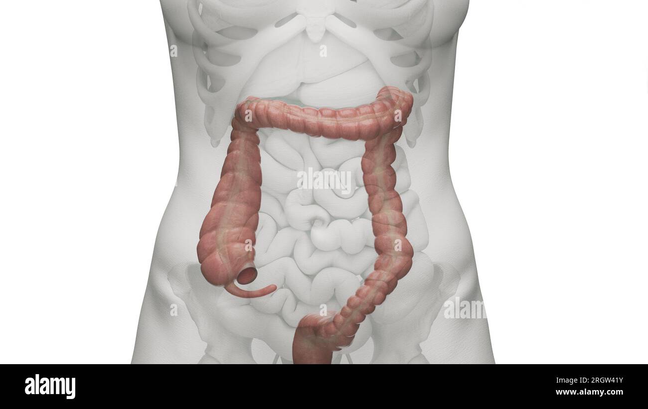 Normal human anatomy appendix colon hi-res stock photography and images ...