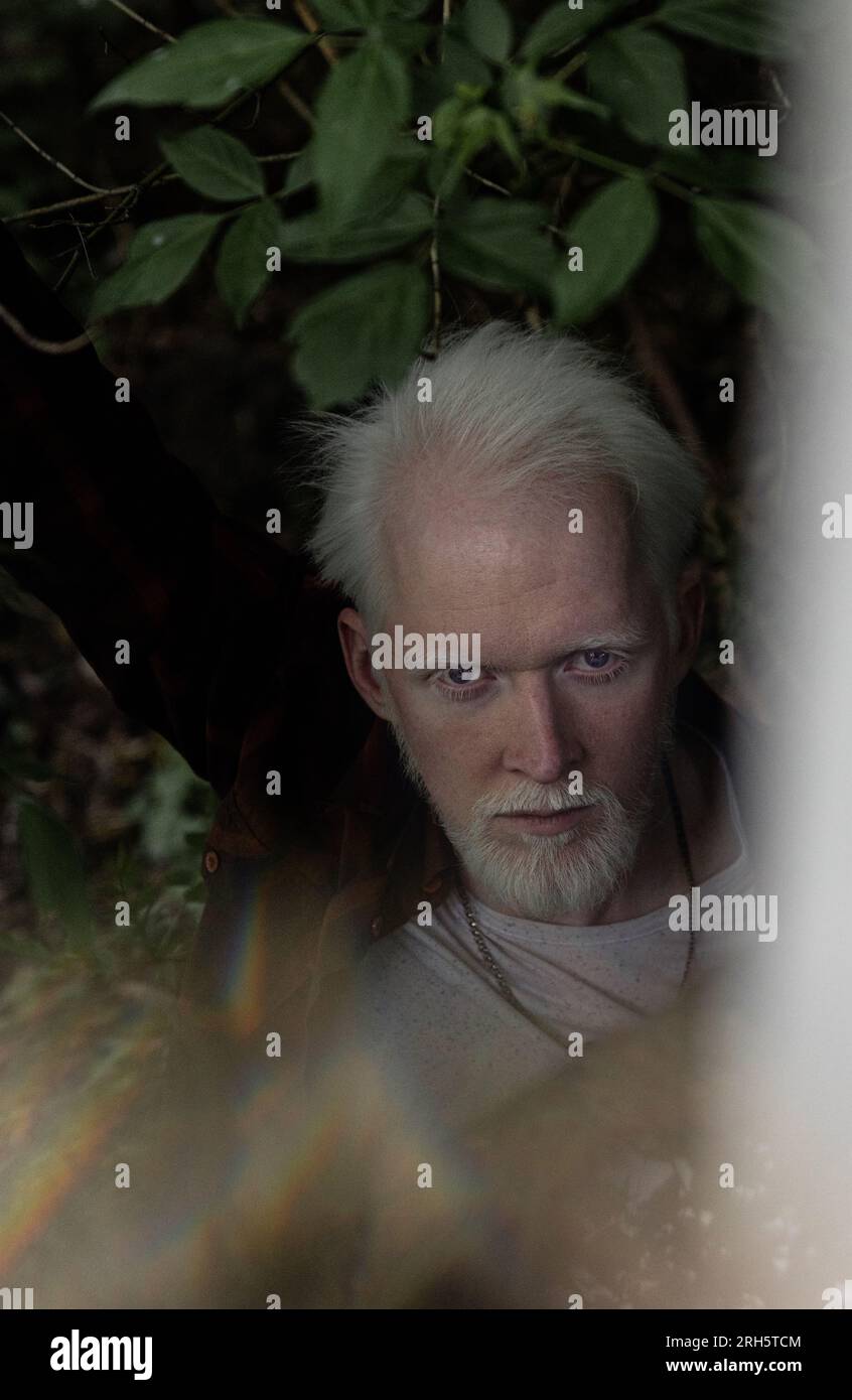 Albino boy hi-res stock photography and images - Alamy