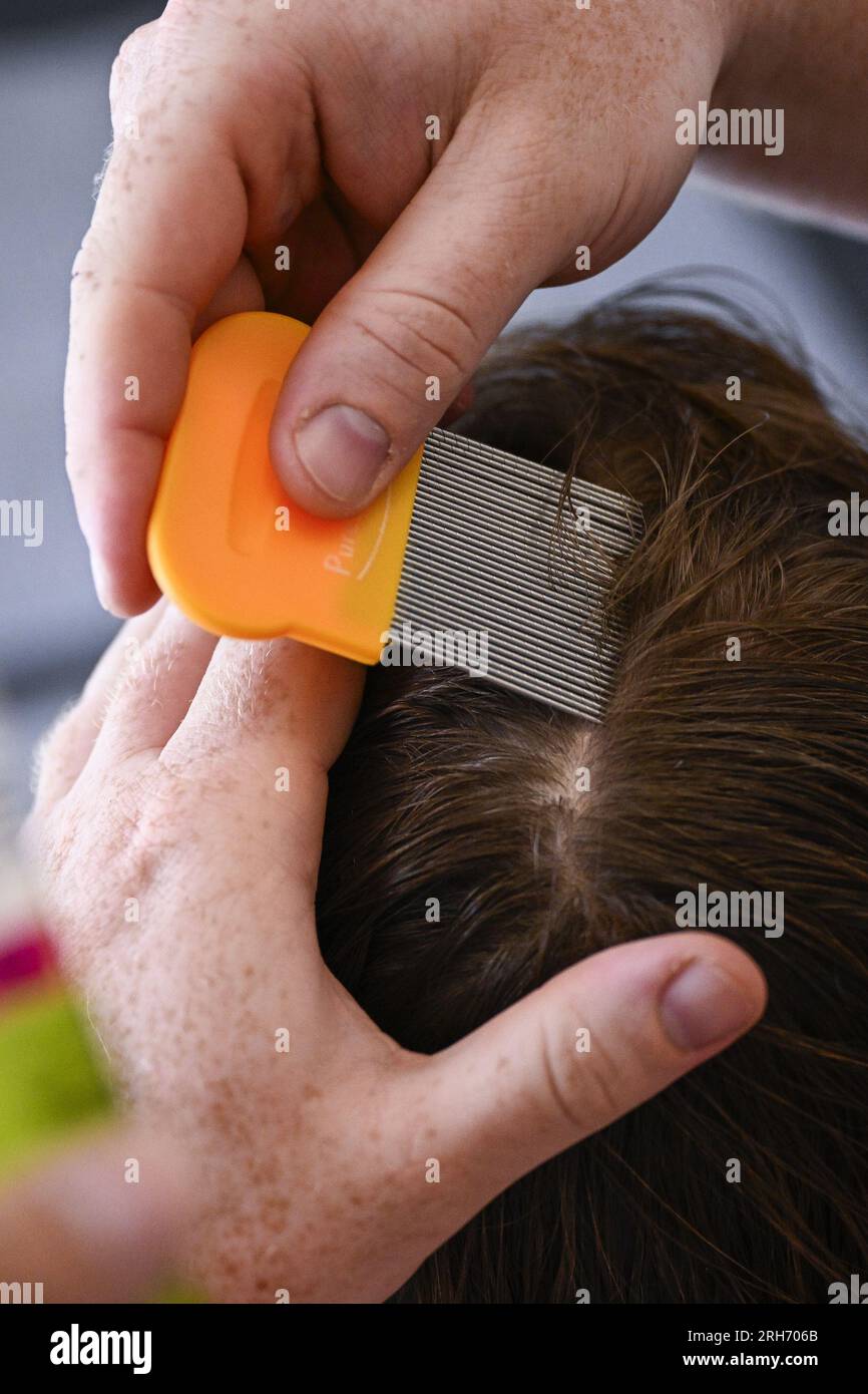 Louse in human hair hi res stock photography and images Alamy