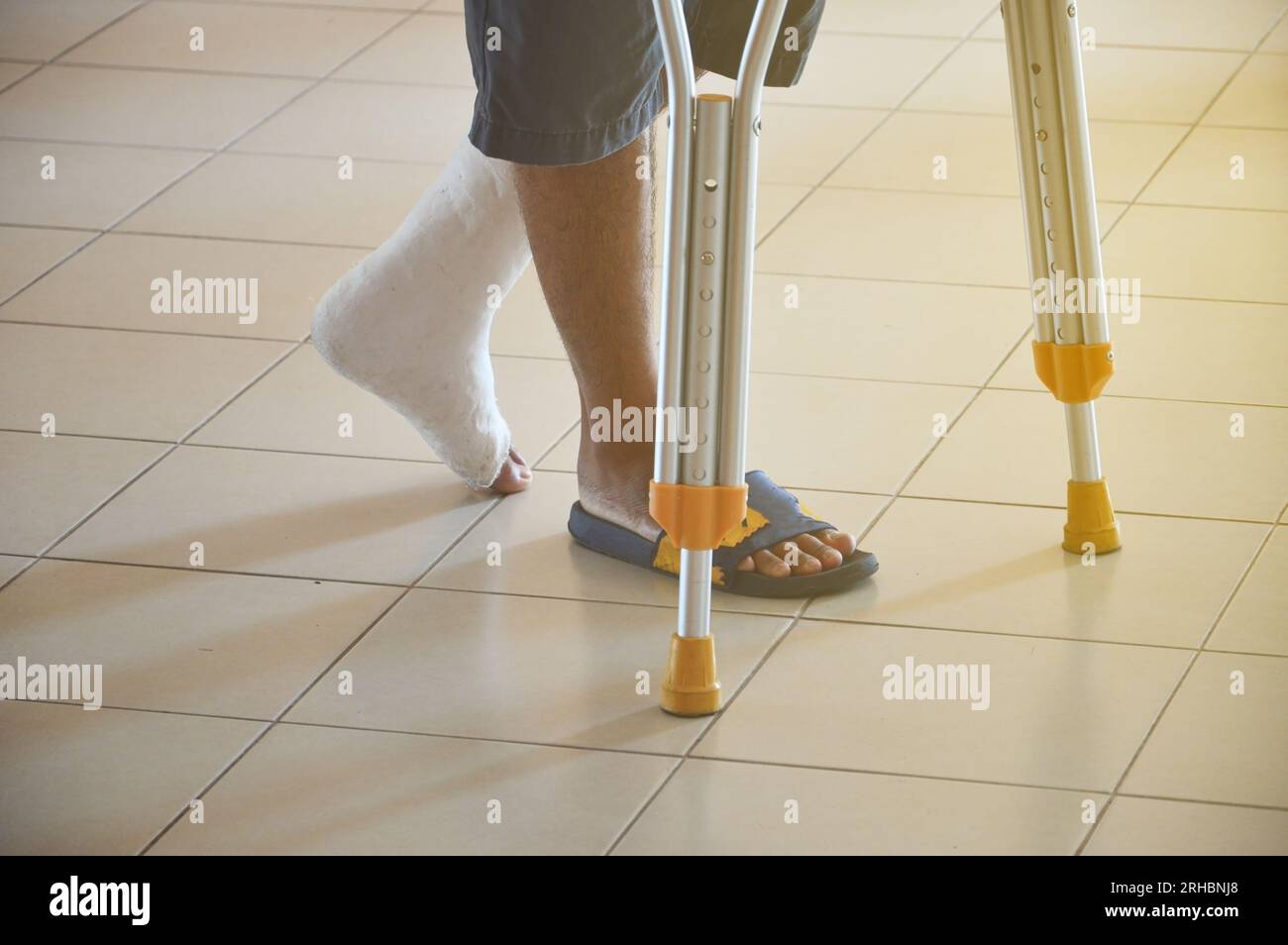 A person who uses a cane, a person with a broken leg wears a cast Stock