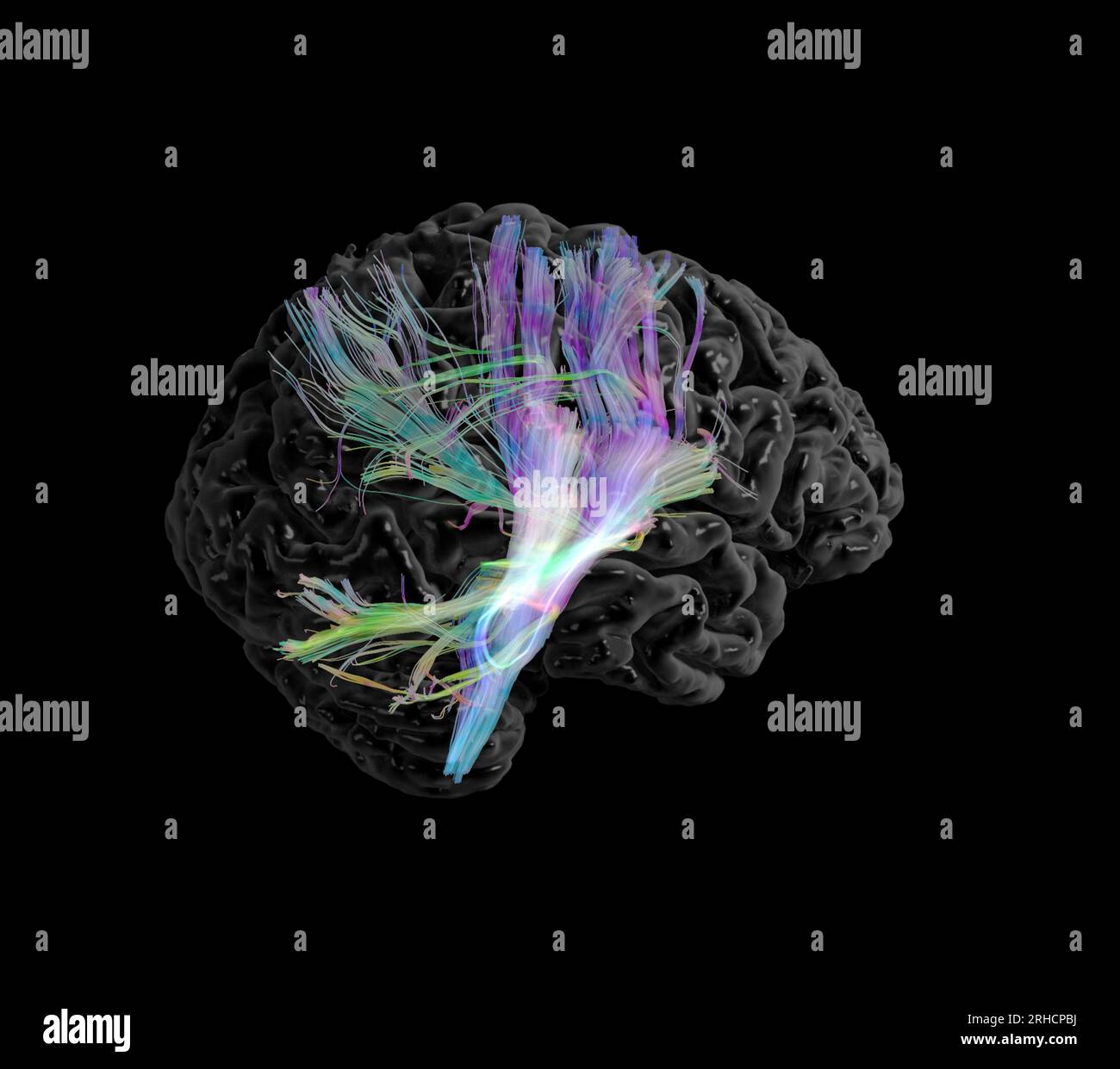 Corticospinal tract, DTI MRI scan Stock Photo - Alamy