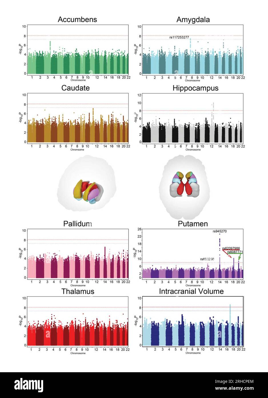 Genetic influences on brain structure, illustration Stock Photo - Alamy