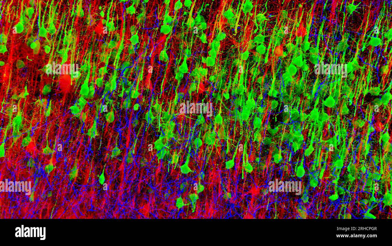 Nerve cells, confocal fluorescent micrograph Stock Photo - Alamy