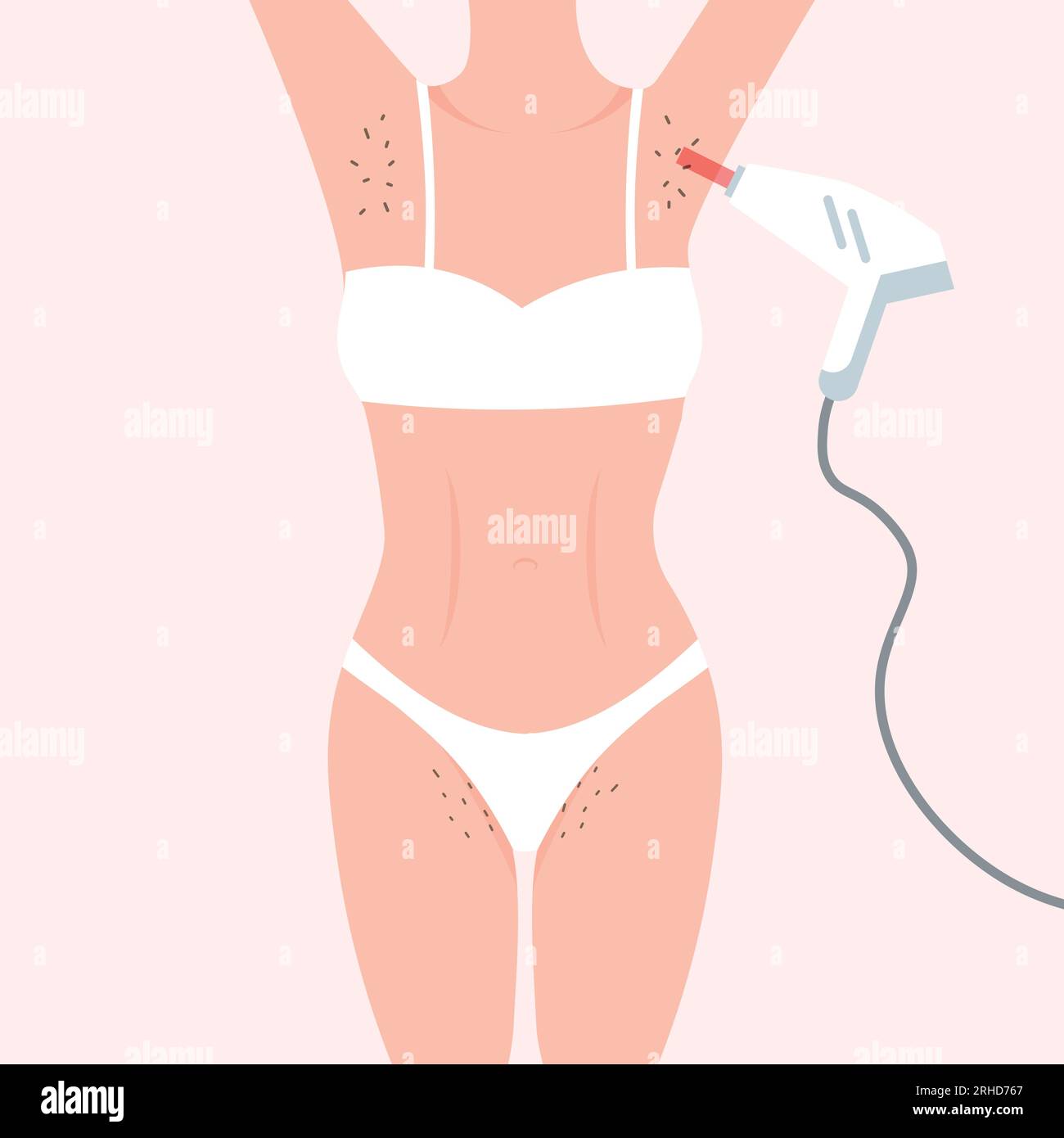 Laser hair removal. Woman hairy armpits and bikini area. Female beauty