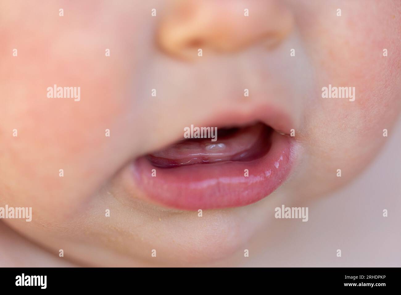 Baby's mouth with first tooth breaking through gum close up Stock Photo