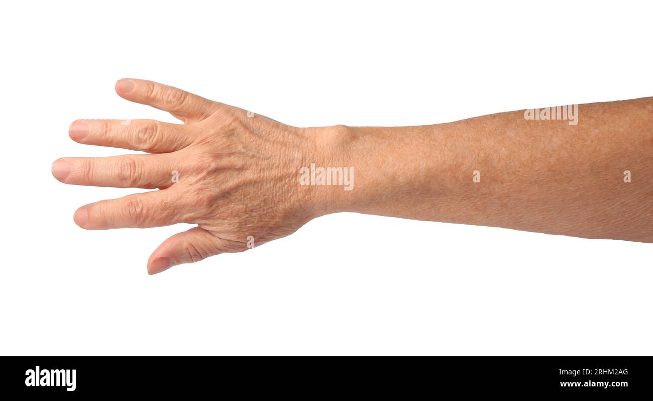 Closeup view of woman's hand with aging skin Stock Photo - Alamy