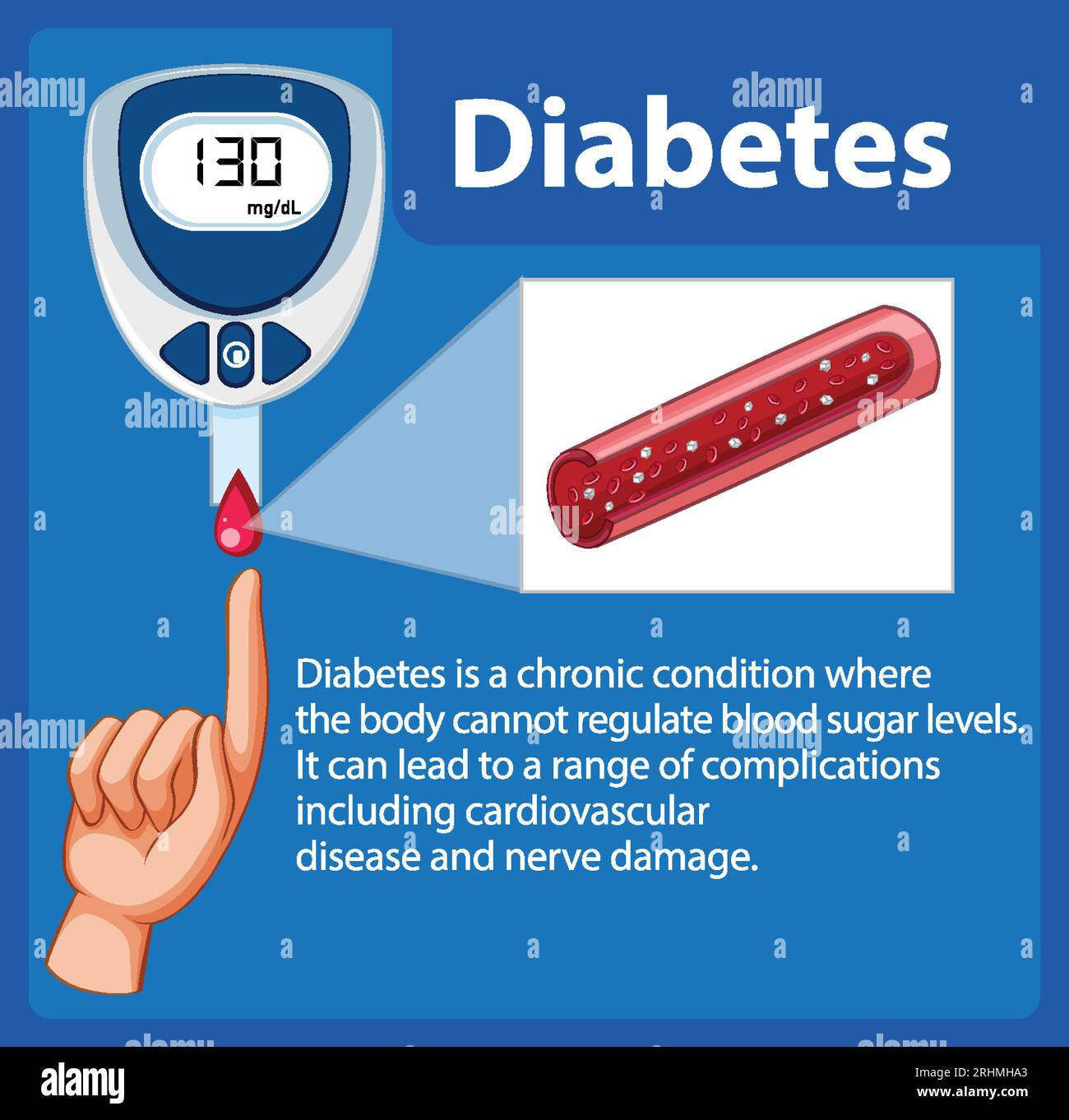 Illustration of a glucose meter device used for checking diabetes Stock ...